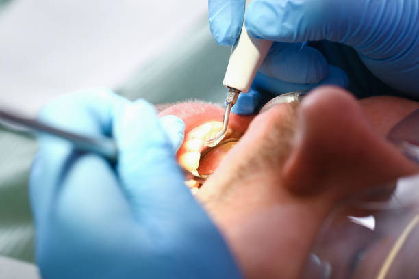 Best Emergency Treatment for Oral Infections in Water Valley, MS