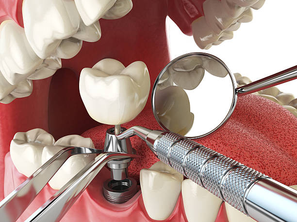 Best Emergency Orthodontic Repairs in Water Valley, MS